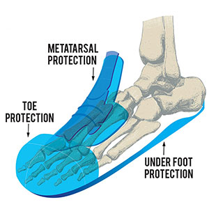 Rhyolite Metatarsal Black S3 Rhyolite Metatarsal Black S3